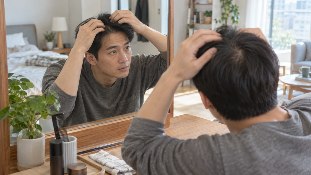 탈모가 걱정되어 자신의 앞머리와 정수리 상태를 확인하는 30대 남성